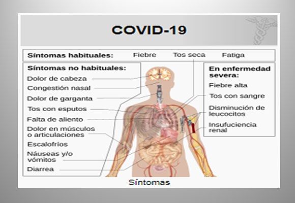 Síntomas del Coronavirus o Covid-19